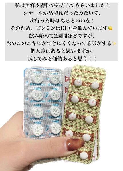 DHC マルチビタミン/DHC/美容サプリメントを使ったクチコミ(4枚目)