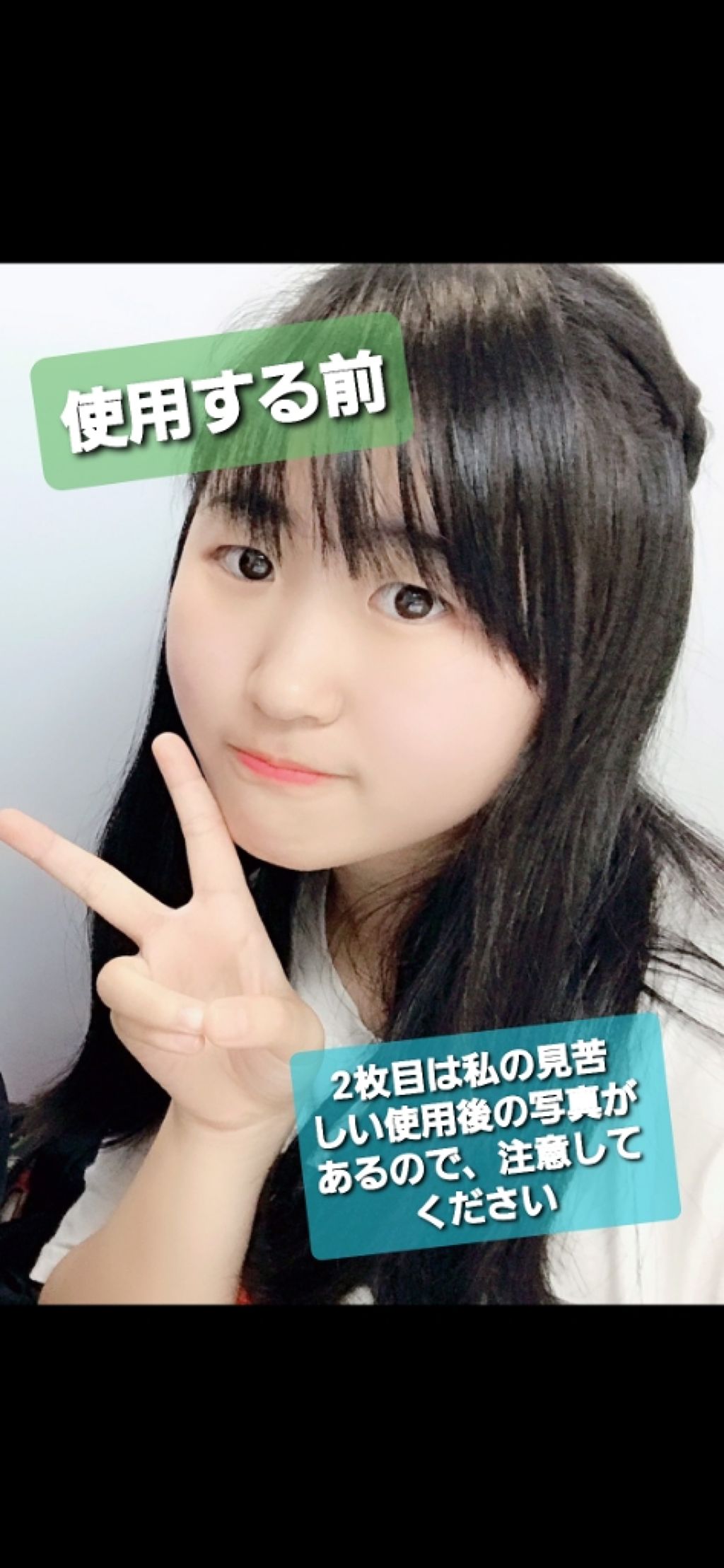 ベピオゲル/マルホ株式会社/その他を使ったクチコミ（1枚目）