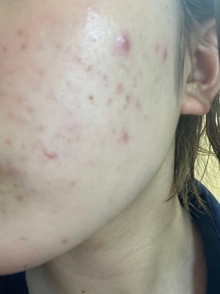 を使ったクチコミ(2枚目)