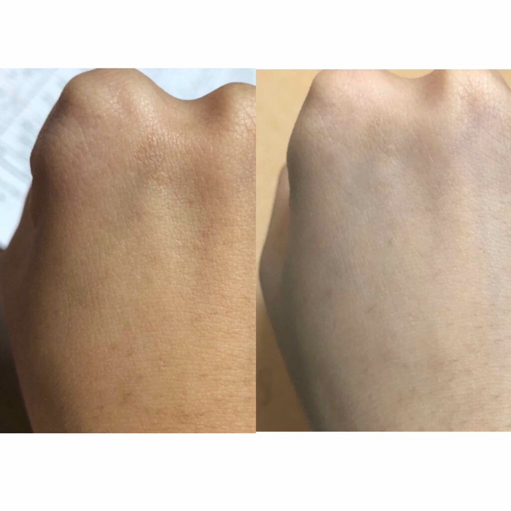 ナイトパック手袋/DAISO/ボディグッズを使ったクチコミ(2枚目)