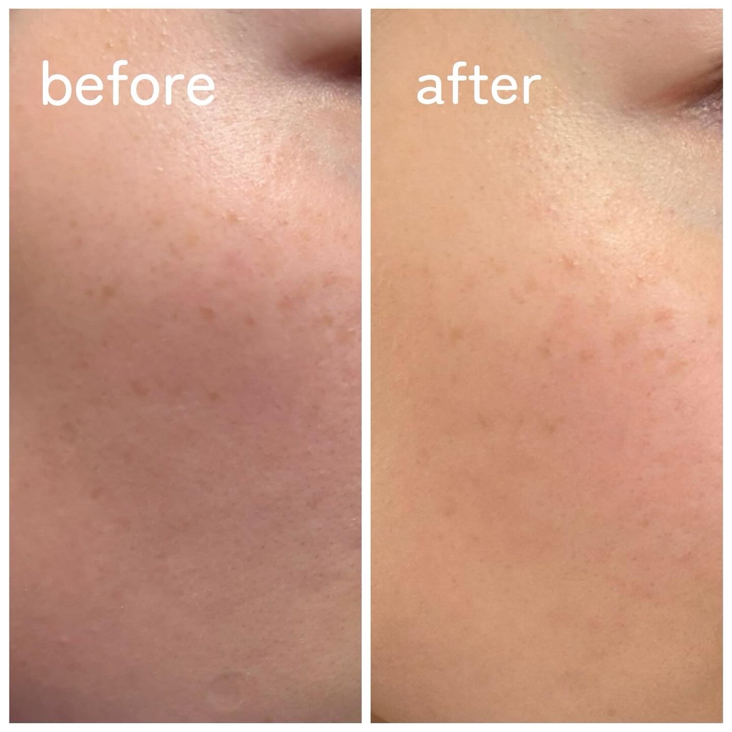 5GF リフティナル ターンオーバー 美容液/Mildlab/美容液を使ったクチコミ(6枚目)