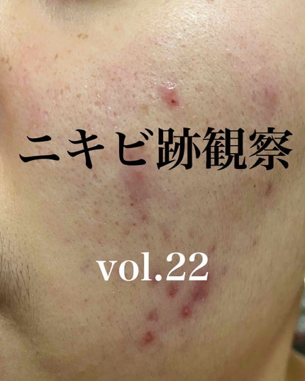 敏感肌用薬用美白美容液/無印良品/美容液を使ったクチコミ(1枚目)