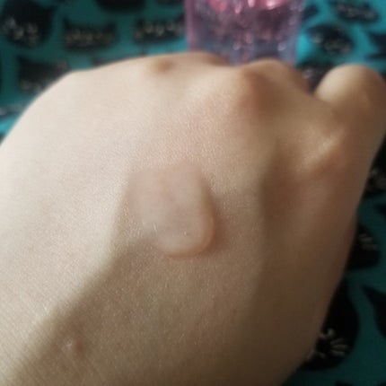 ピンクティーツリートナー/APLIN/化粧水を使ったクチコミ(5枚目)