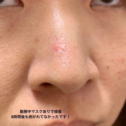 ごめんね素肌 キニシナイパッチ/クリアターン/シートマスク・パックを使ったクチコミ(8枚目)