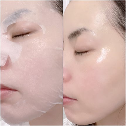 ブルーブライトマスク/EMROSÉ/シートマスク・パックを使ったクチコミ(3枚目)