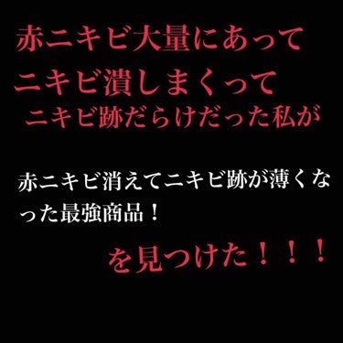 VC100エッセンスローション
こんにちは！ルナです

今回はニキビにめちゃくちゃ悩んでた私の肌を変えてくれたこちらの商品を紹介します！！！


私はニキビを潰しまくっていてニキビ跡が大量…そして赤ニキ