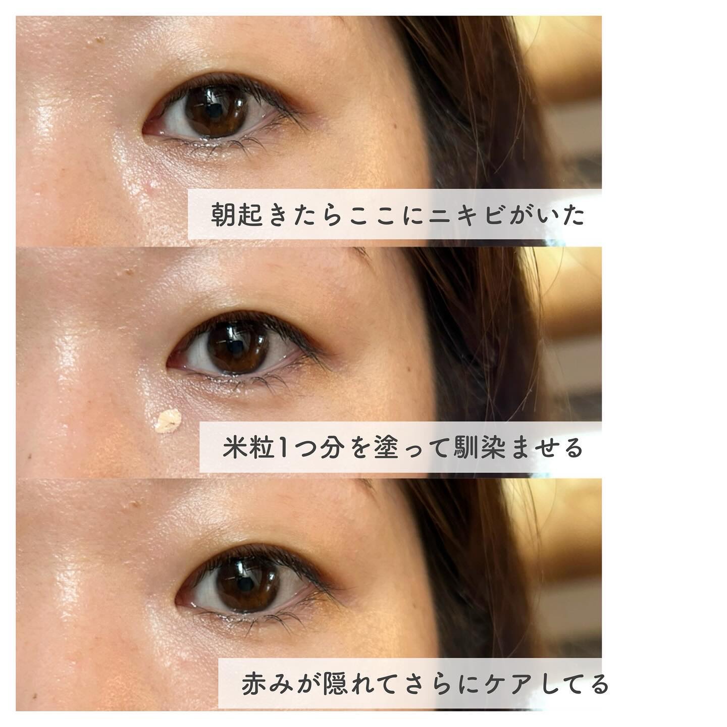 イプノス シーバムクリア リペアクリーム/ACSEINE/フェイスクリームを使ったクチコミ（3枚目）