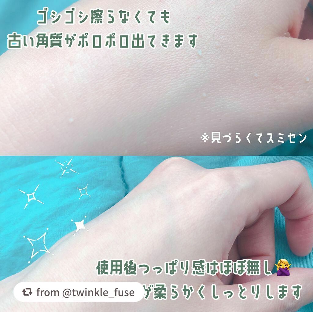 フェイシャルマイルドピーリング/primera/ピーリングを使ったクチコミ(3枚目)