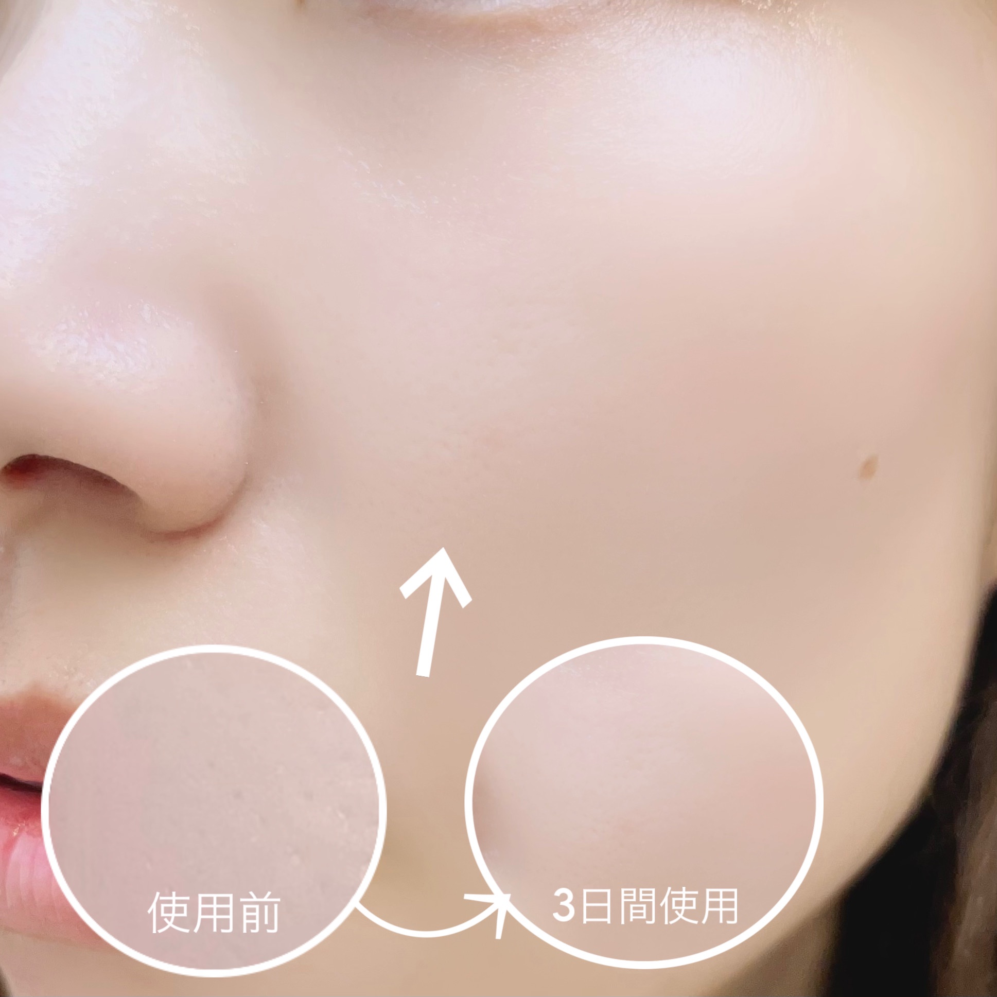 ダイヤリフト1000 SHOT/ECLIMOI/ブースター・導入液を使ったクチコミ（3枚目）