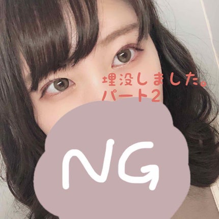 二重整形/その他を使ったクチコミ(1枚目)