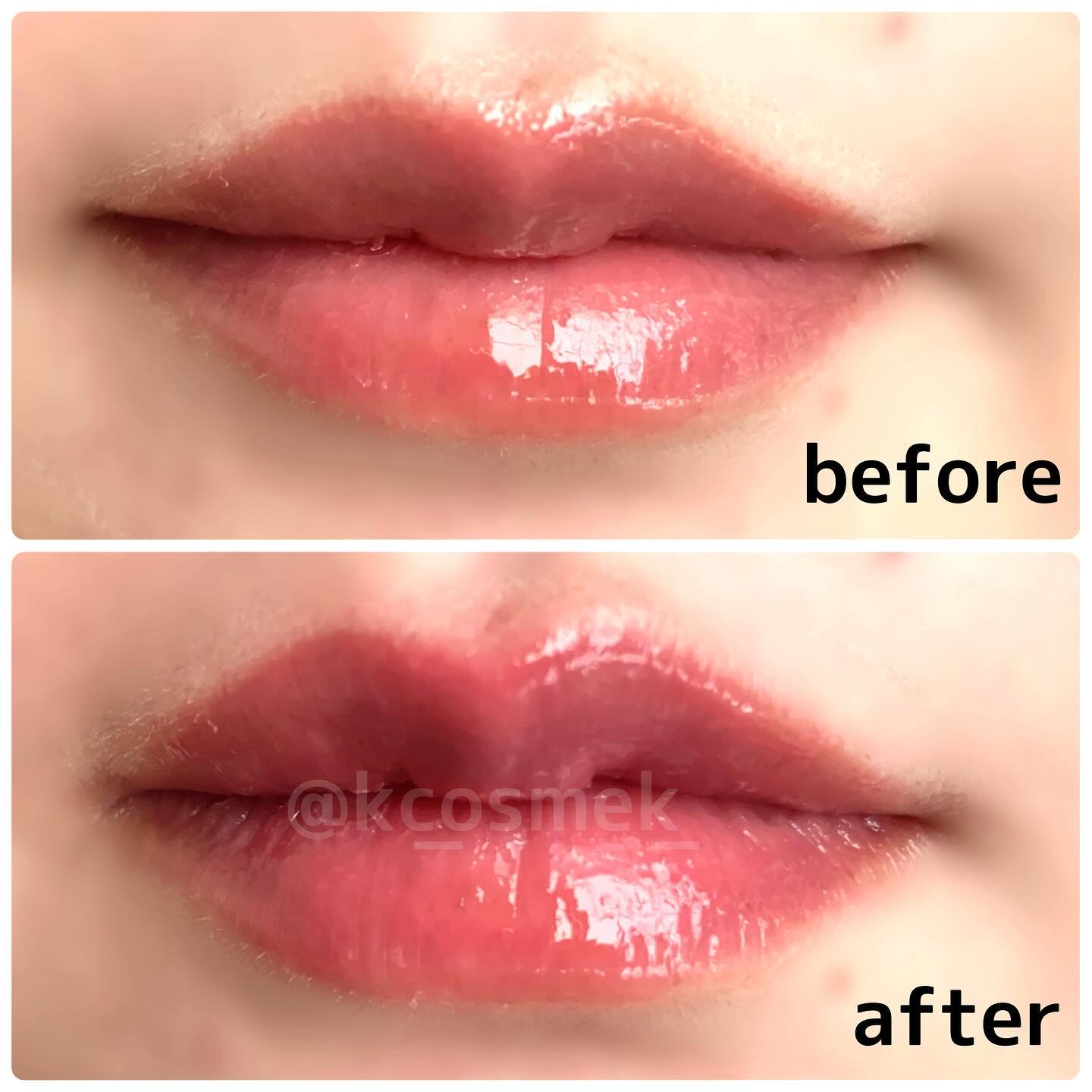 ボリュームリッププランパー/BANILA CO/リッププランパーを使ったクチコミ（3枚目）