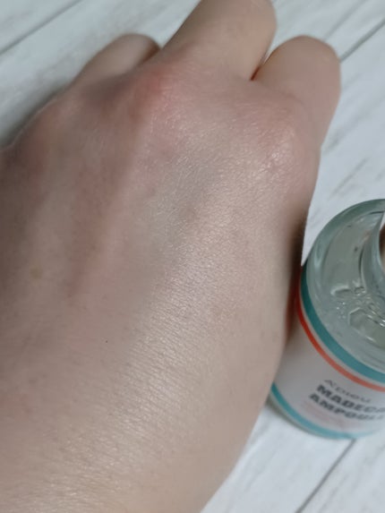 マデカソ 美容液/A’pieu/美容液を使ったクチコミ(4枚目)