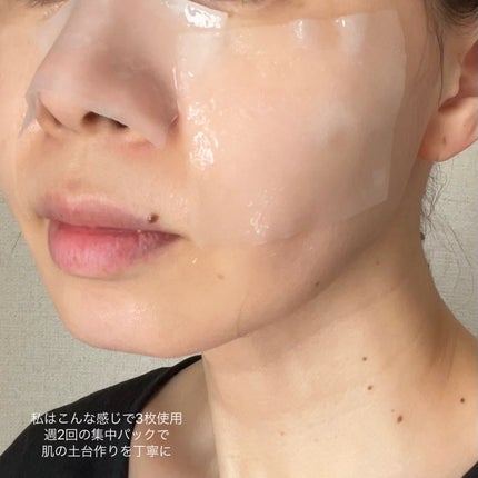 リズム べース ポイント集中パック(ブラック)/RISM/シートマスク・パックを使ったクチコミ(4枚目)