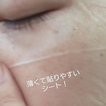 シカアルブチンマスク/NOWATER/シートマスク・パックを使ったクチコミ(5枚目)