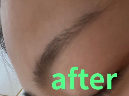 ニキビーニ 乾燥肌・敏感肌用/LilyBell/シートマスク・パックを使ったクチコミ(7枚目)