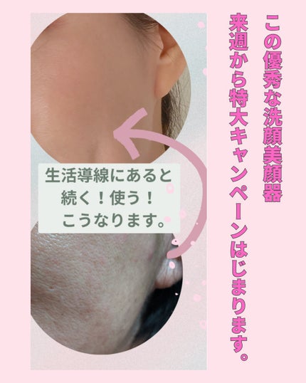 美肌カウンセラー💆肌悩みを解決し見る世界を変える on LIPS 「肌を綺麗にする専門家💆美肌カウンセラー洗顔で可愛くなる時代\肌..」(6枚目)