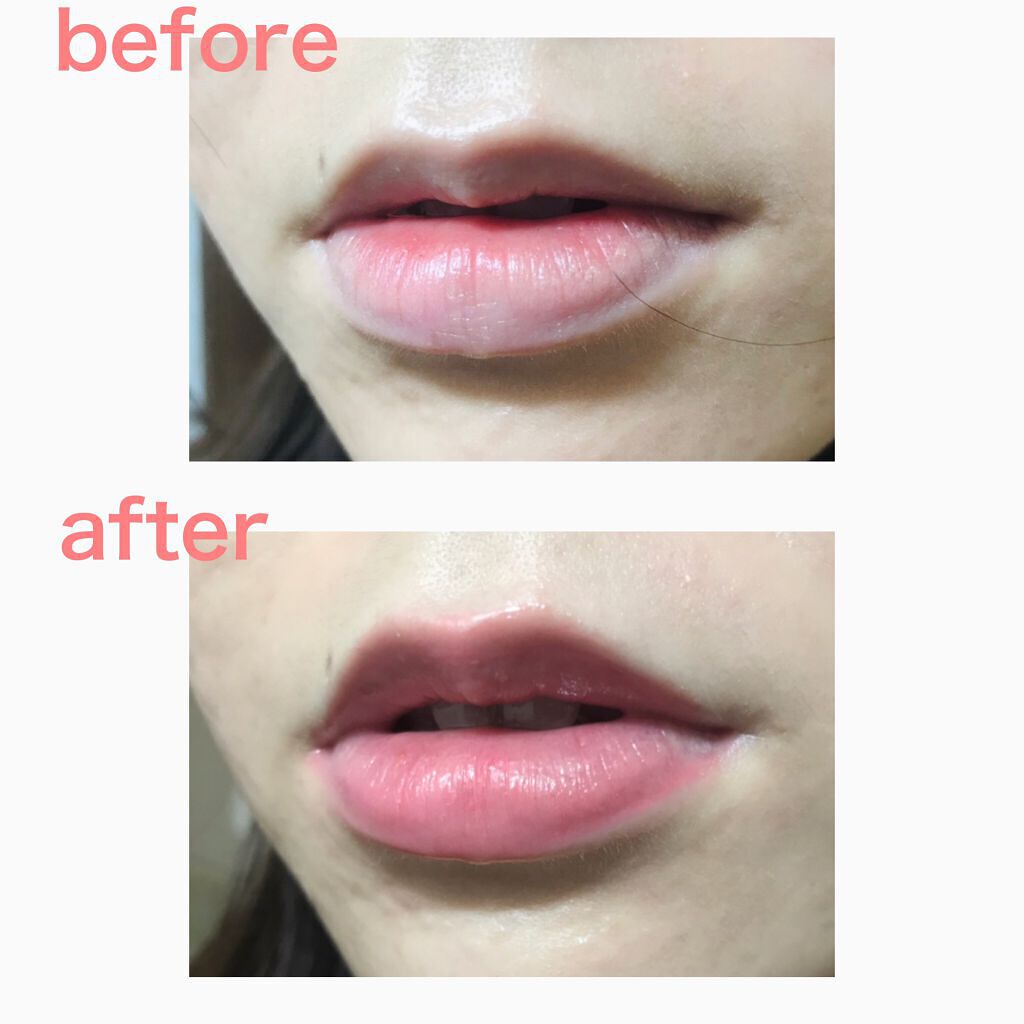 38°C / 99°F リップトリートメント (リップ美容液)/UZU BY FLOWFUSHI/リップケアを使ったクチコミ(3枚目)