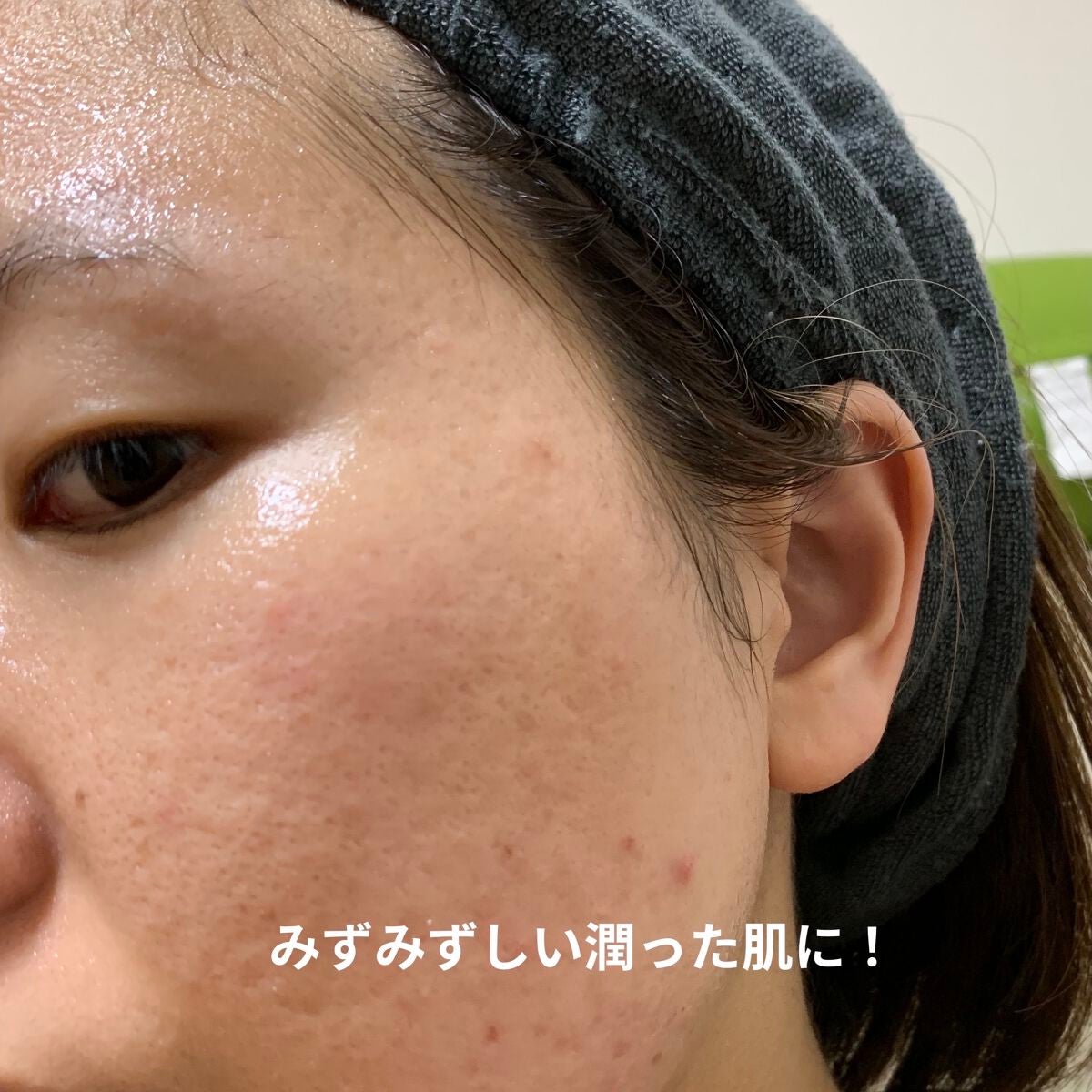 毛穴小町マスク /クリアターン/シートマスク・パックを使ったクチコミ(6枚目)