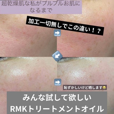 RMK Wトリートメントオイル/RMK/ブースター・導入液を使ったクチコミ（1枚目）