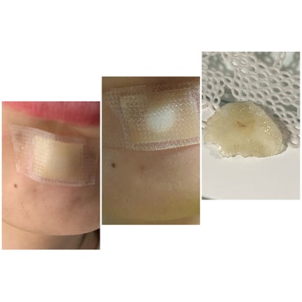 キズパワーパッド/バンドエイド/その他を使ったクチコミ(4枚目)