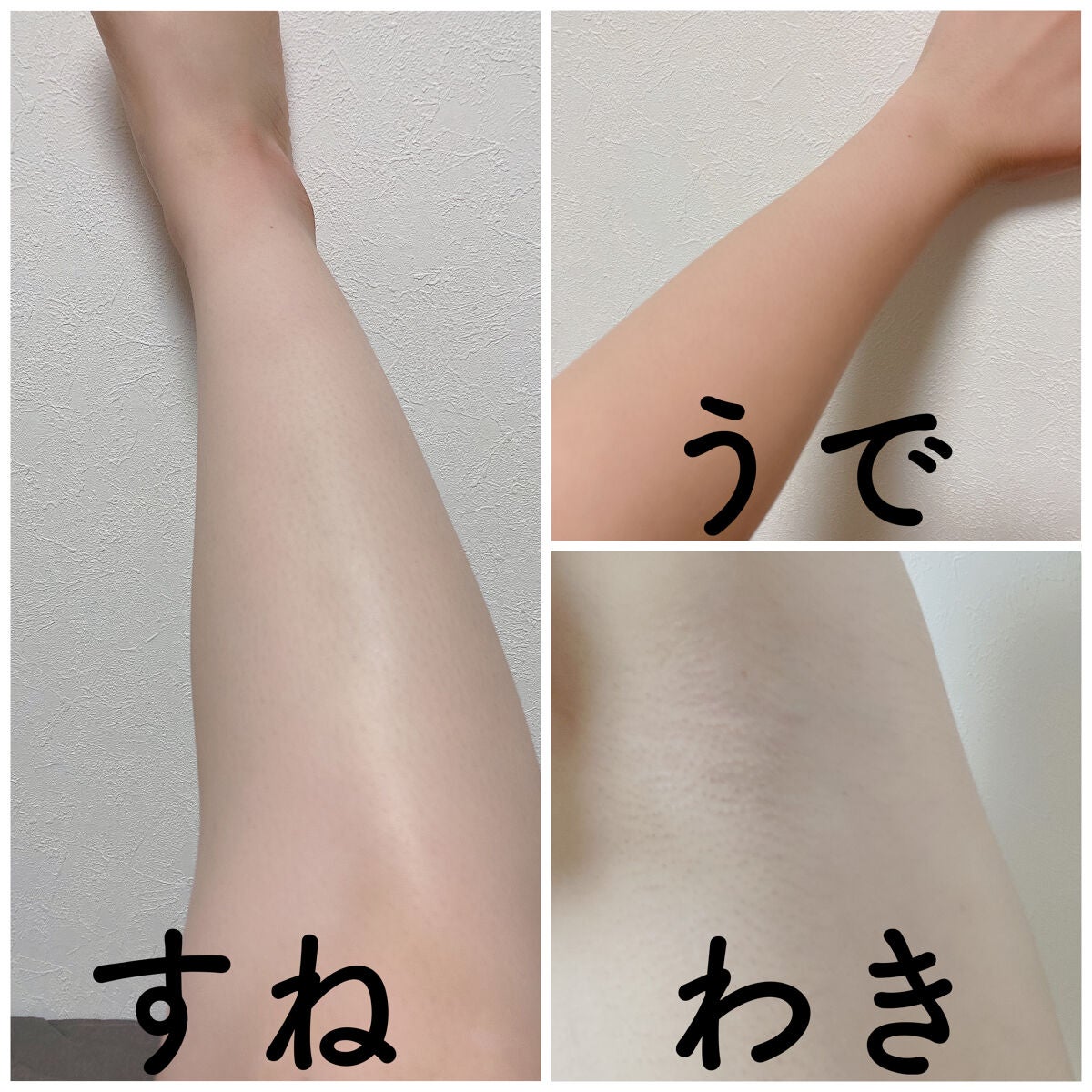 光美容器KE-NON(ケノン)/エムテック/家庭用脱毛器を使ったクチコミ(4枚目)