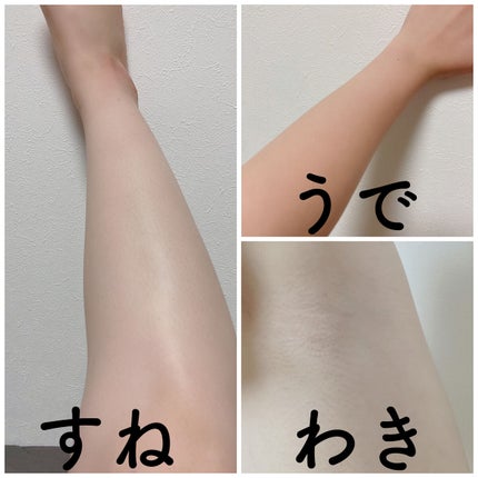 光美容器KE-NON(ケノン)/エムテック/家庭用脱毛器を使ったクチコミ(4枚目)