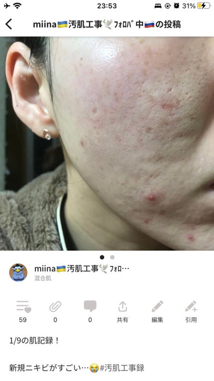 Cサスペンション23+HAスフィア2フェイスクリーム/The Ordinary/美容液を使ったクチコミ(3枚目)