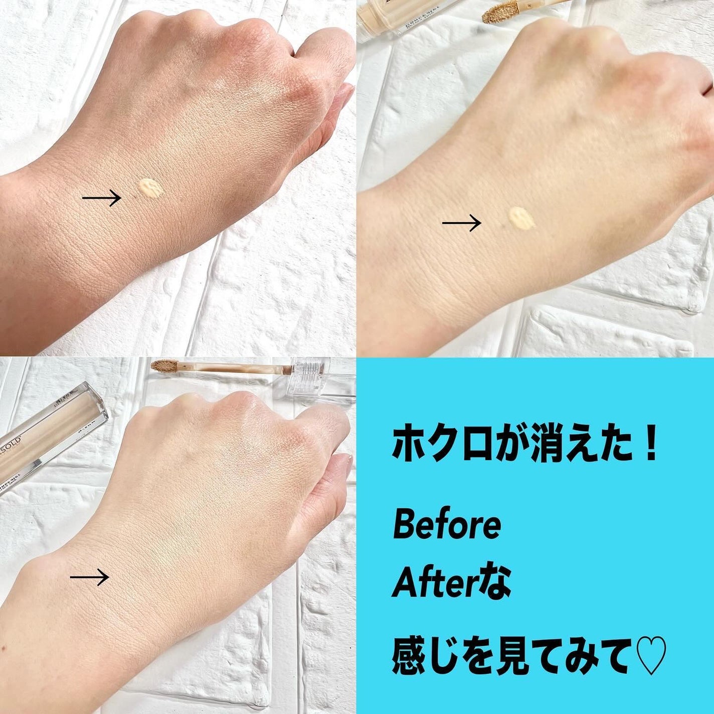 ダーマシンコンシーラー/23years old/リキッドコンシーラーを使ったクチコミ(6枚目)