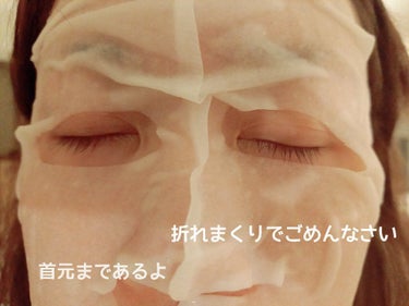 超浸透3Dマスク エイジングケア (超もっちり)/肌美精/シートマスク・パックを使ったクチコミ（2枚目）