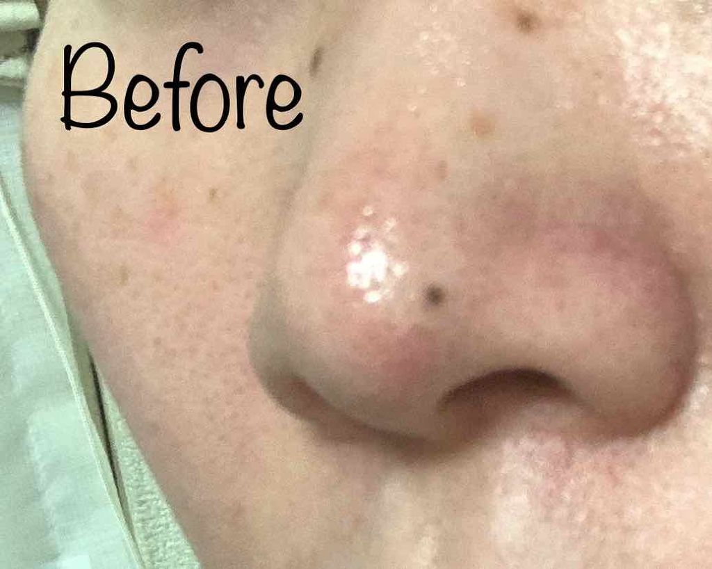 ドラマティックパウダリー UV/マキアージュ/パウダーファンデーションを使ったクチコミ(1枚目)