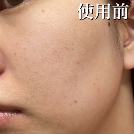 ピンクティーツリーカバーアップグロウクッション/APLIN/クッションファンデーションを使ったクチコミ(5枚目)