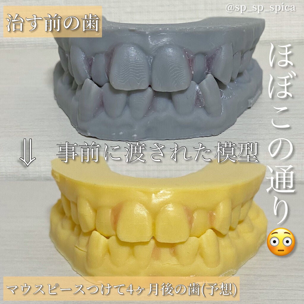 オーラツーミー アロマフレーバーコレクション ペースト/オーラツー/歯磨き粉を使ったクチコミ(4枚目)