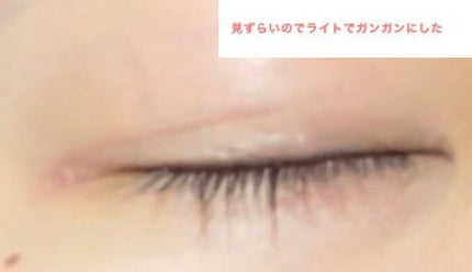 アイテープ(絆創膏タイプ、レギュラー、70枚)/DAISO/二重まぶた用アイテムを使ったクチコミ(3枚目)