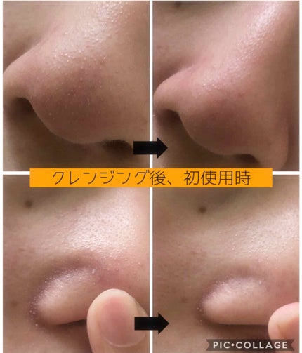 オバジC 酵素洗顔パウダー/オバジ/洗顔パウダーを使ったクチコミ(2枚目)