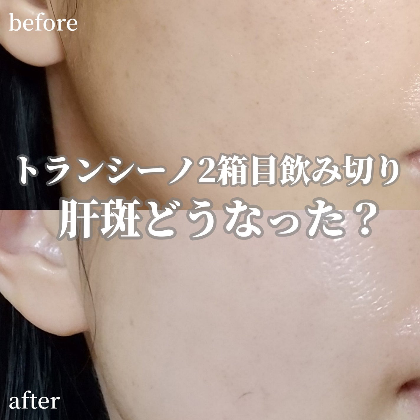 ビタペアC ダークスポットセラム/ネイチャーリパブリック/美容液を使ったクチコミ(1枚目)