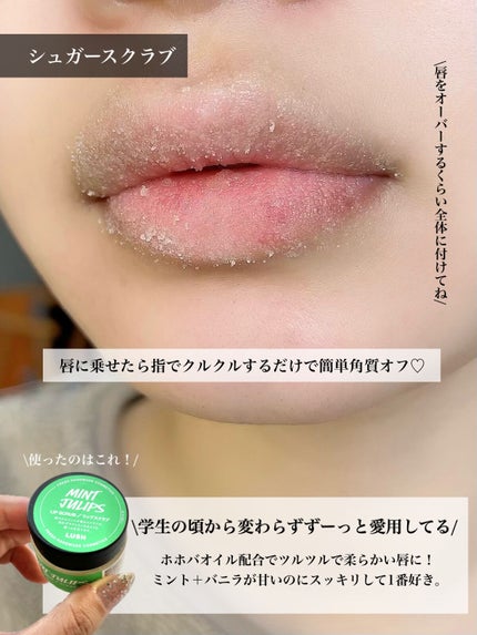 リップ美容液/WHOMEE/リップ美容液を使ったクチコミ(3枚目)