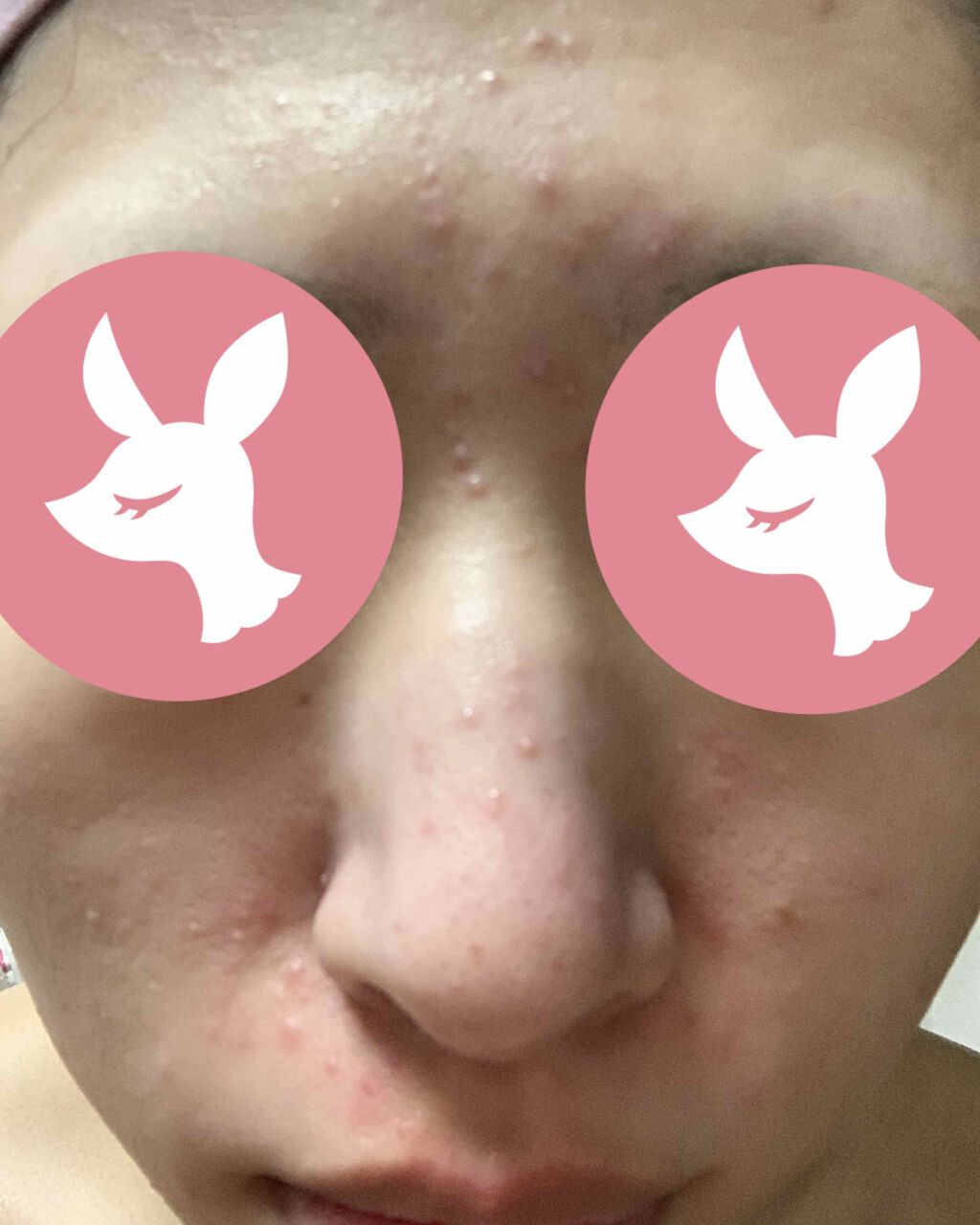 薬用 しみ 集中対策 美容液/メラノCC/美容液を使ったクチコミ(2枚目)