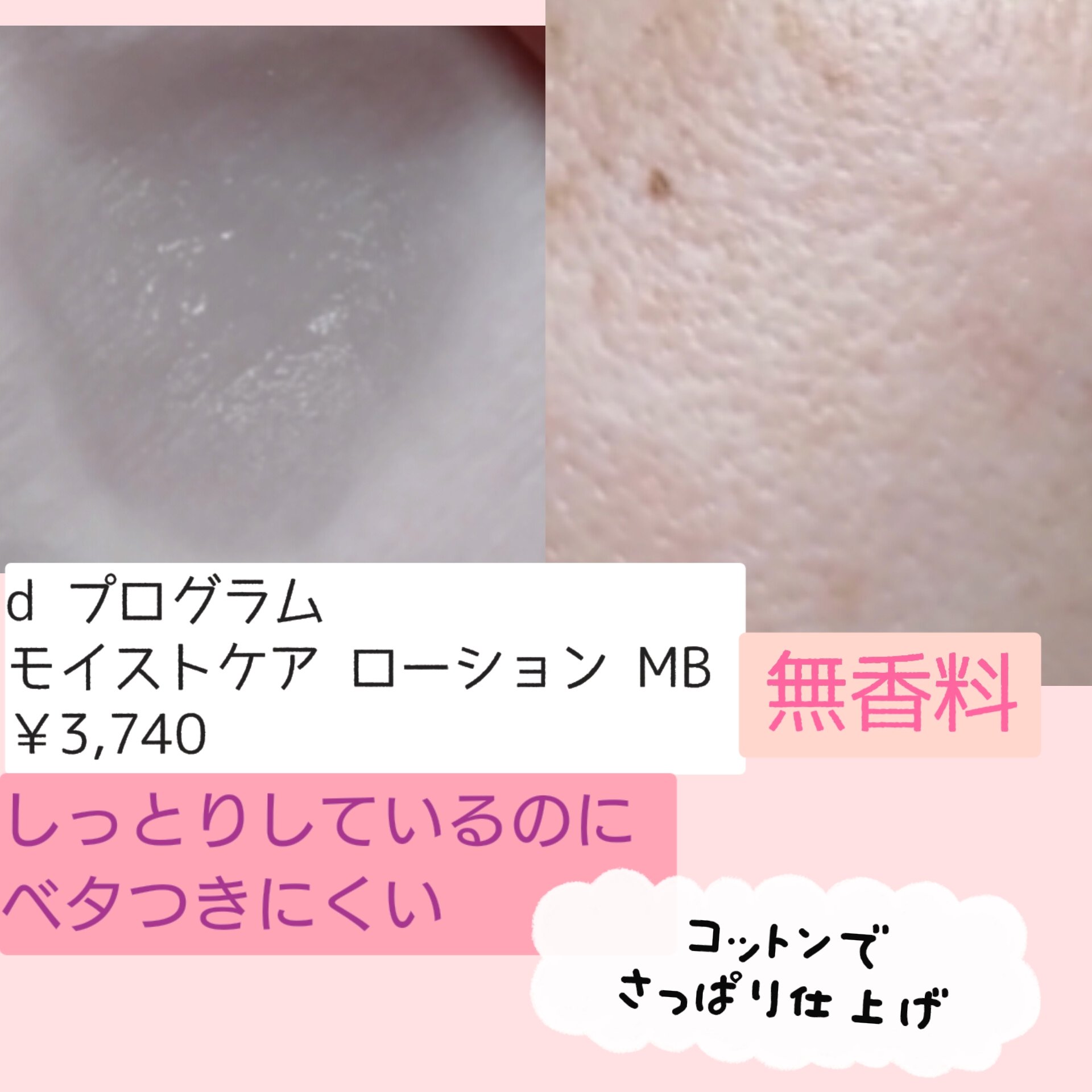 薬用 アクネケア美容液/d プログラム/美容液を使ったクチコミ（3枚目）