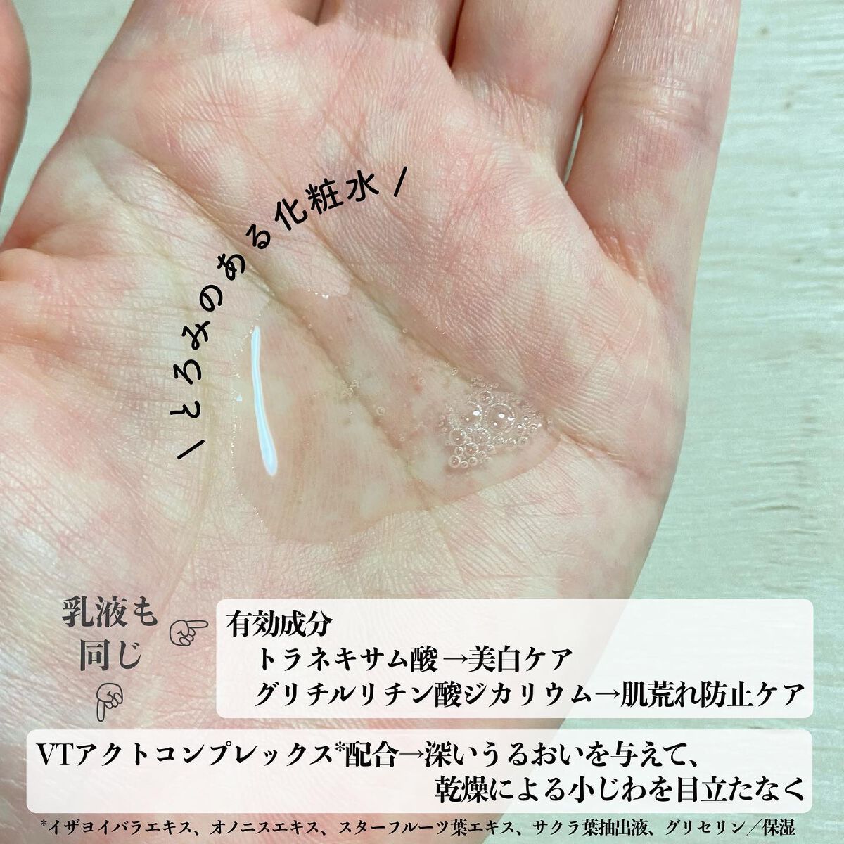 バイタルアクト エマルジョン MB 本体/d プログラム/乳液を使ったクチコミ（3枚目）