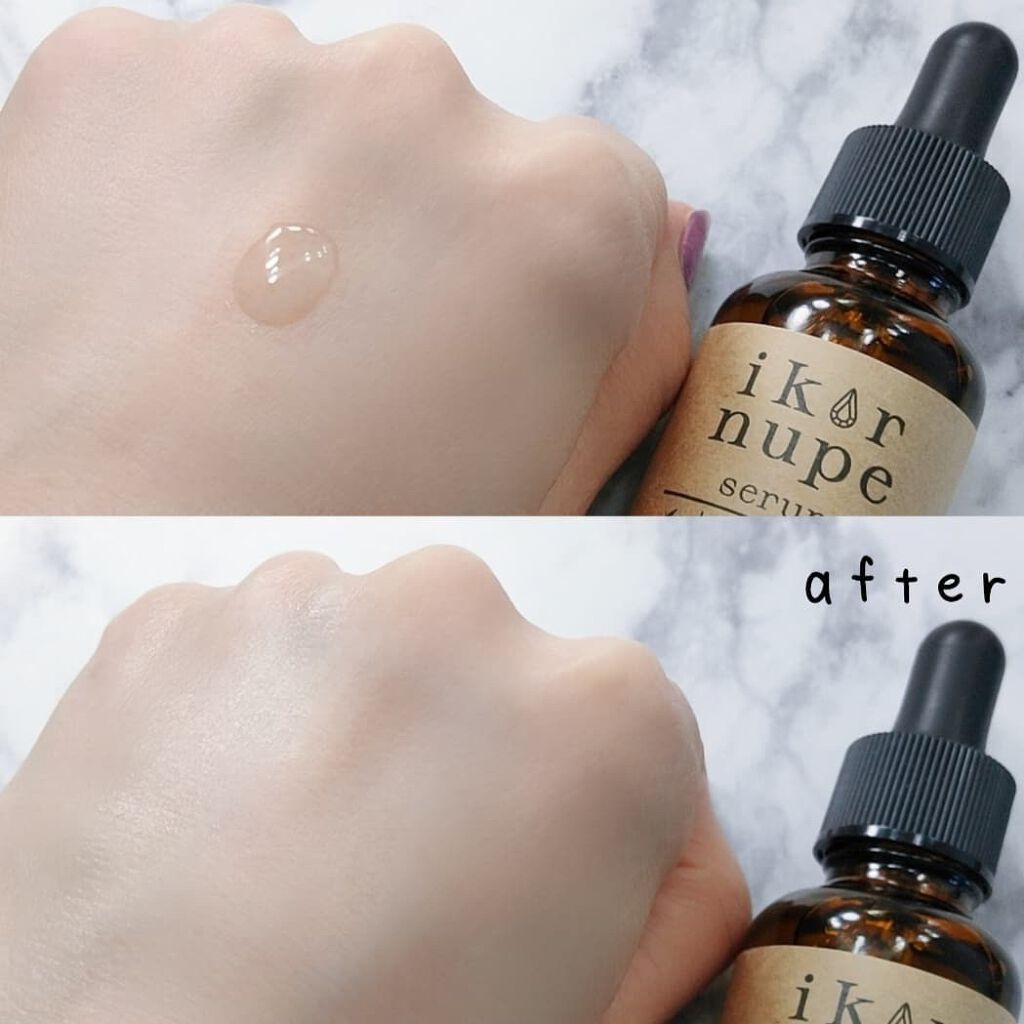 イコロ ヌペ セラム/健康コーポレーション/美容液を使ったクチコミ(4枚目)