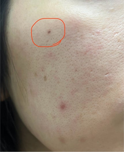 CICA エアリーUVスティック/VT/日焼け止めスティックを使ったクチコミ(4枚目)