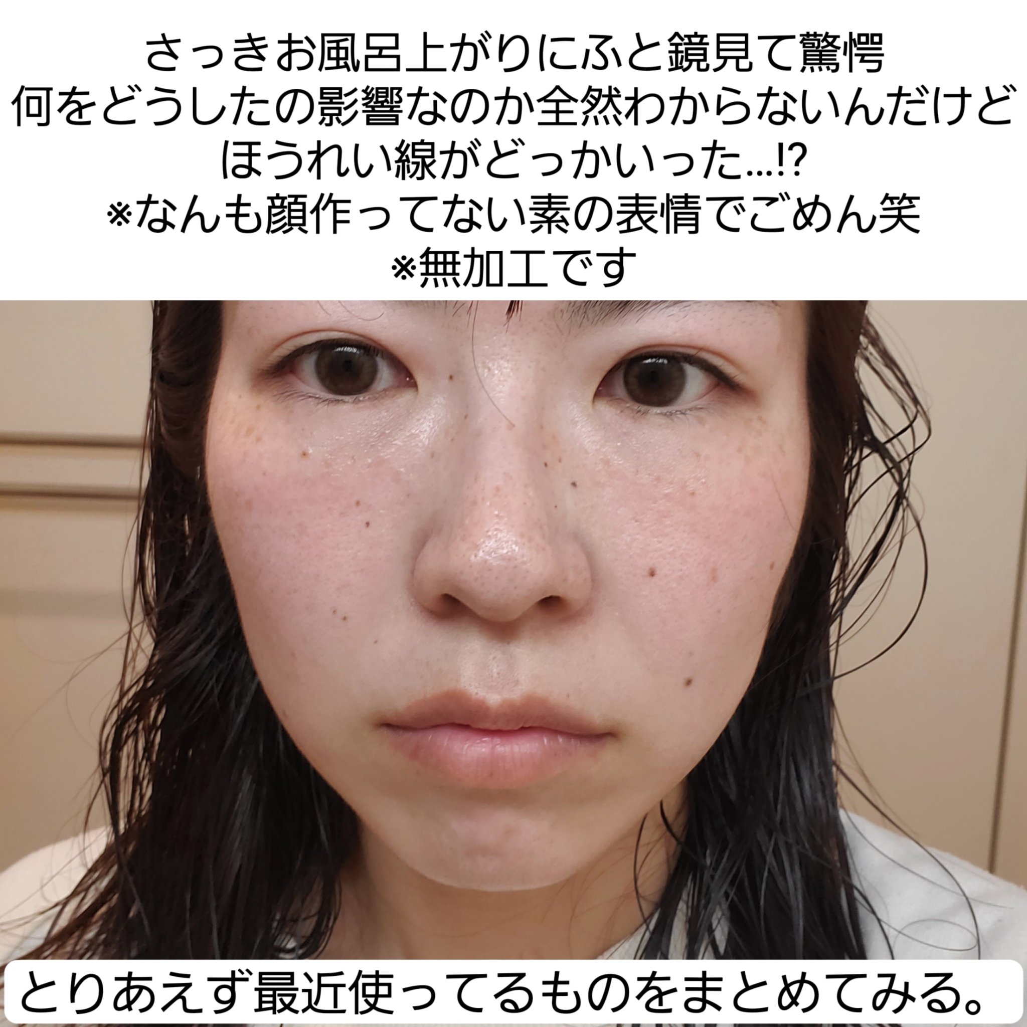 タカミスキンピール/タカミ/ブースター・導入液を使ったクチコミ（3枚目）