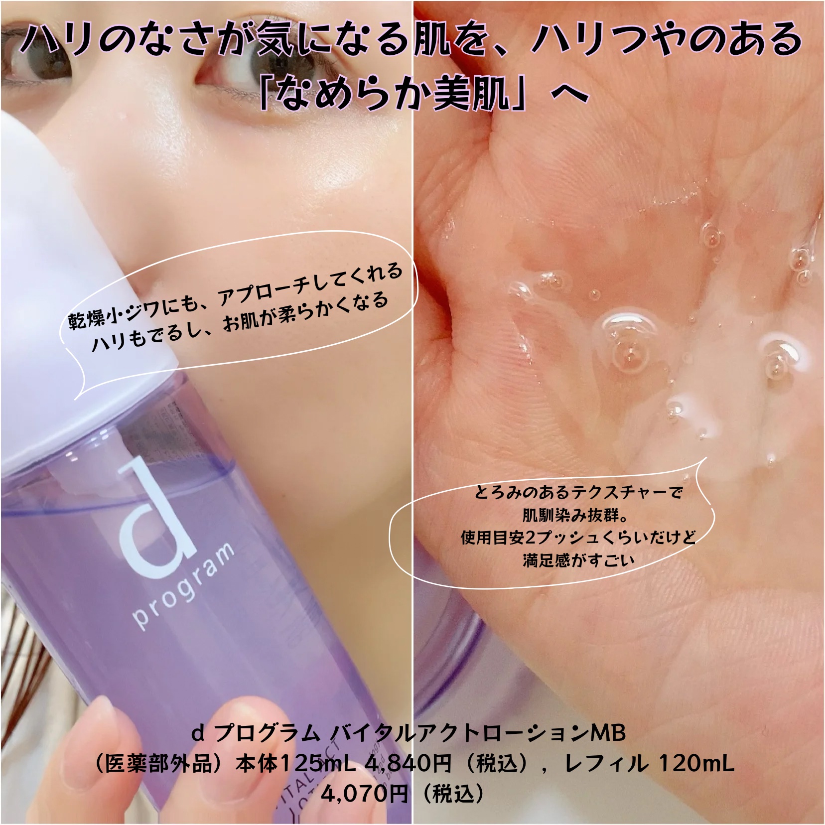 バイタルアクト ローション MB/d プログラム/化粧水を使ったクチコミ（3枚目）