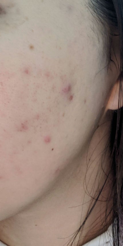 薬用しみ対策 美白化粧水/メラノCC/化粧水を使ったクチコミ(2枚目)