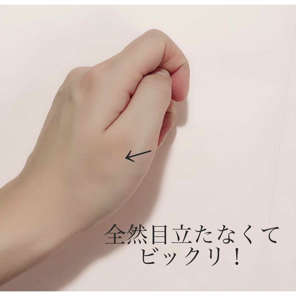 ゼロスポットパッチ/Today’s Cosme/にきびパッチを使ったクチコミ(4枚目)