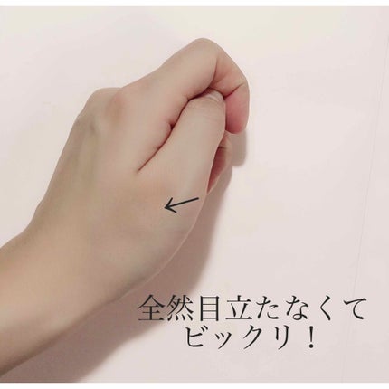 ゼロスポットパッチ/Today’s Cosme/にきびパッチを使ったクチコミ(4枚目)