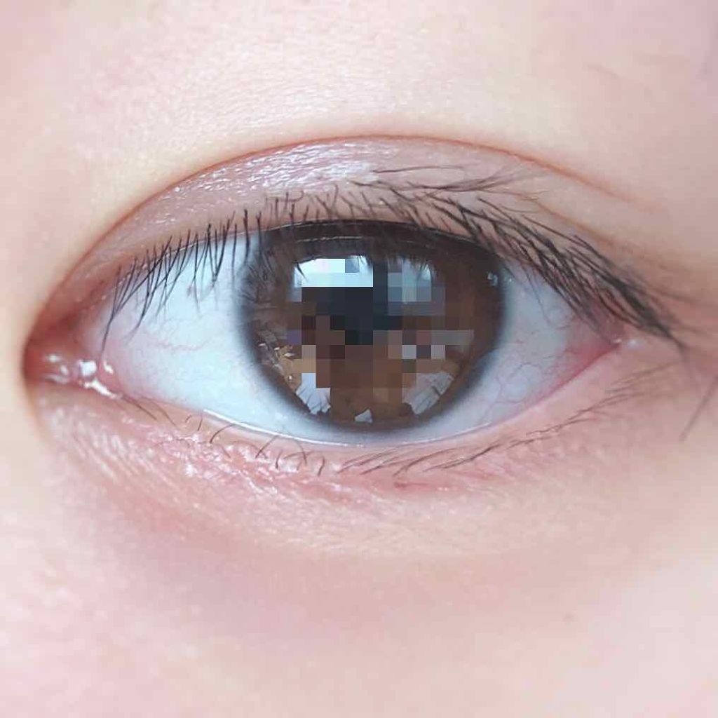 しなやかフィット/DAISO/二重まぶた用アイテムを使ったクチコミ(2枚目)