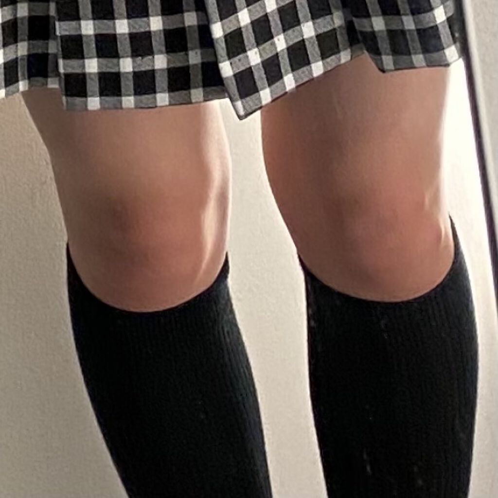 ニベアクリーム ニベアを使った口コミ 膝の黒ずみ私の膝はめちゃくちゃ黒かったん By ハート Lips