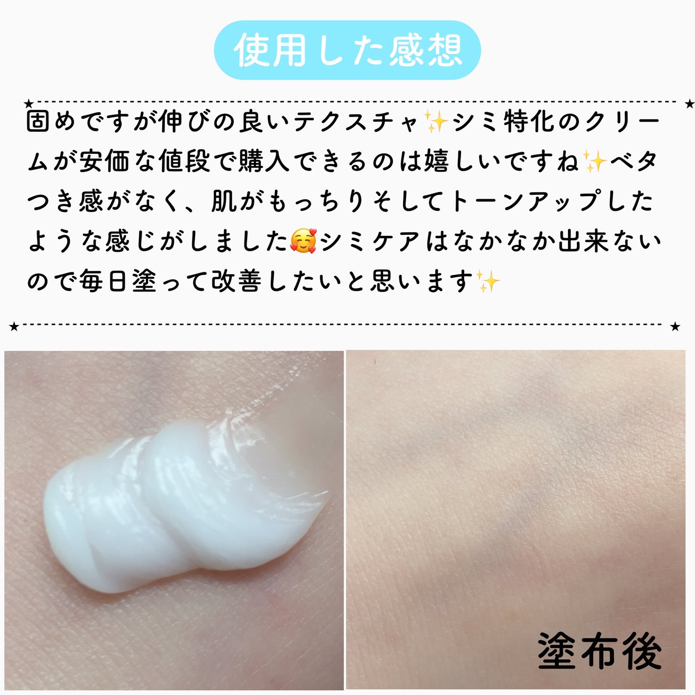 TX-Cream/Dr.Melaxin/フェイスクリームを使ったクチコミ(6枚目)