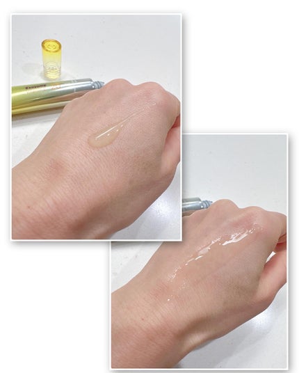 fuzukiフォロバ♡ on LIPS 「渡韓以来、すっかりハマってしまった肌管理。そんな美容医療"肌管..」(4枚目)